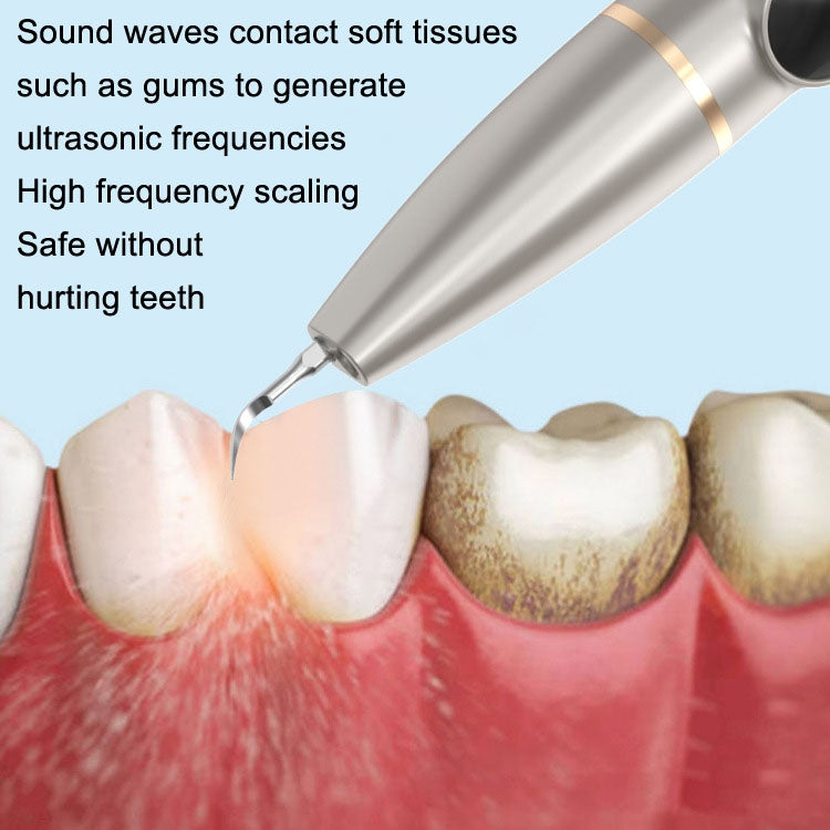 Tartar and Calculus Remover Oral Cleaning Ultrasonic Scaler Electric Visual Scaler(Green) - Oral Irrigators by buy2fix | Online Shopping UK | buy2fix